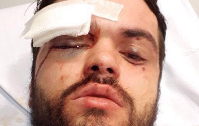 Jugador de rugby argentino está hospitalizado tras ataque homófobo